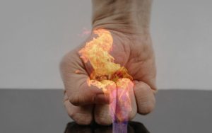 Lee más sobre el artículo ¿Qué tipos de quemaduras existen y cómo reconocerlas?